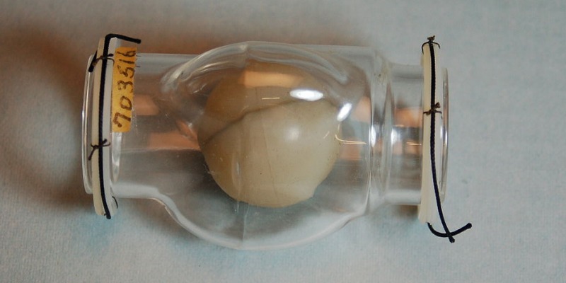 https://www.rmix.it/ - 1952: La Plastica Entra per la Prima Volta nel Cuore di una Donna
